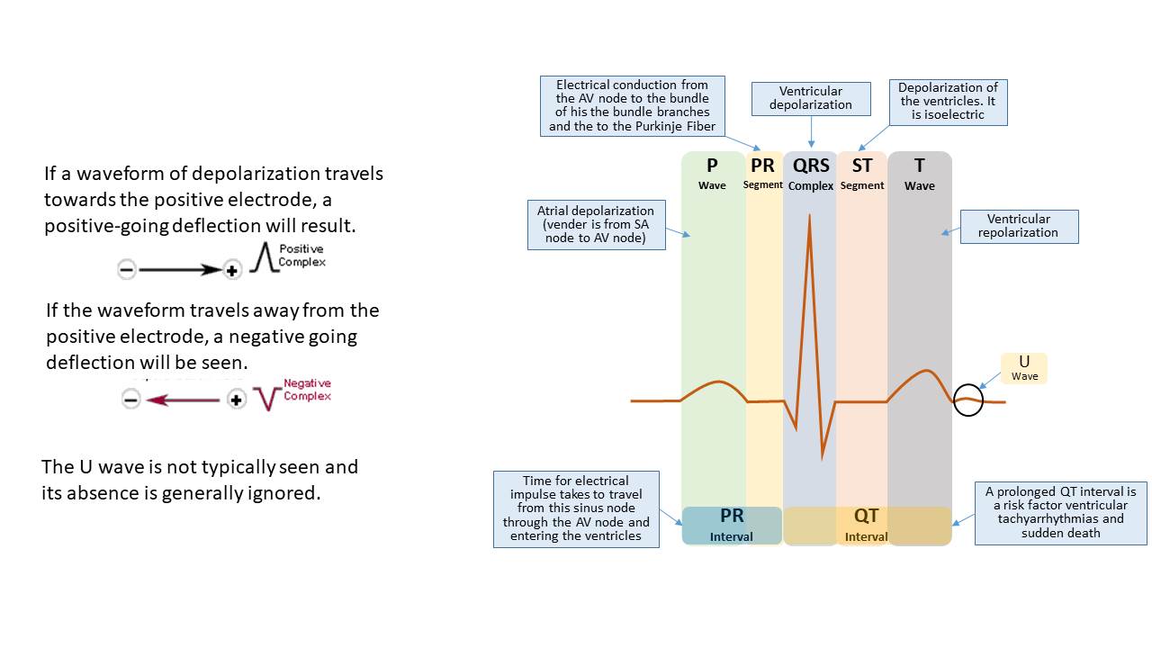 Understanding ECG Waveform